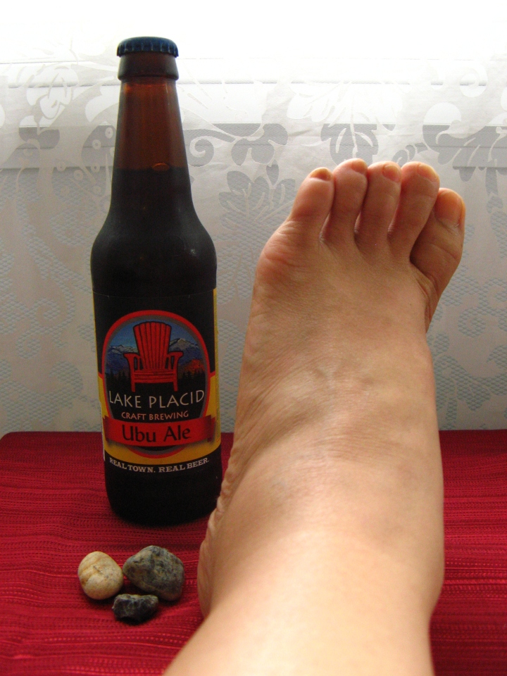 Adirondacks souvenirs -- local microbrew, pebbles from Lake Colden and an angry ankle
